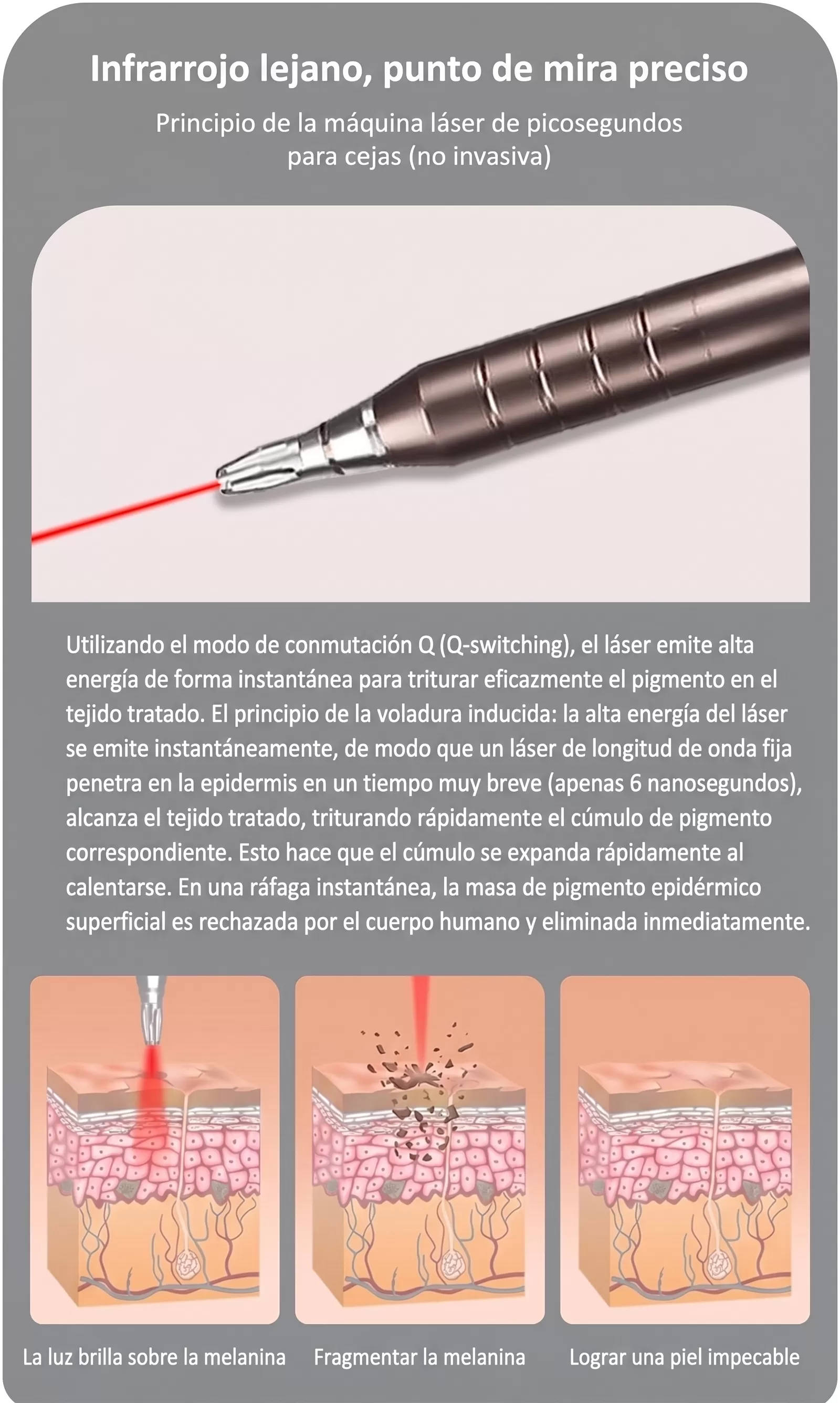 Removedora de tatuajes